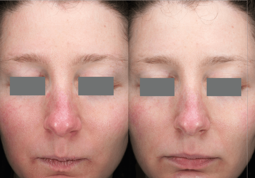 Institute For Medical Aesthetics And Laser | Medical Aesthetics Training Florida | Laser Hair Removal Training in Florida | Massage School | Beauty School in Fort Myers